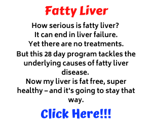 Nonalcoholic Fatty Liver Disease Treatment Review