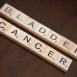 Treatment-Of-Bladder-Cancer2-150×150